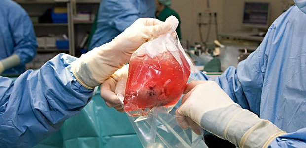 Nierentransplantationen ersparen den Betroffenen mehrere langwierige Dialysesitzungen pro Woche. Foto: horizong 21/Fotolia